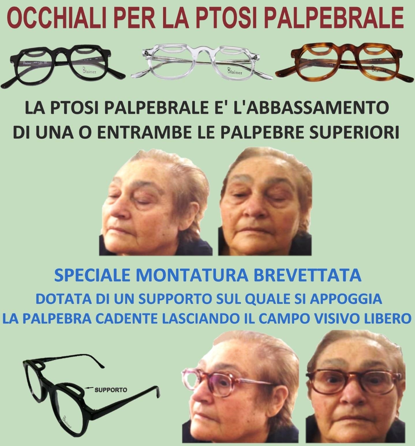 Occhiali per Ptosi Palpebrale