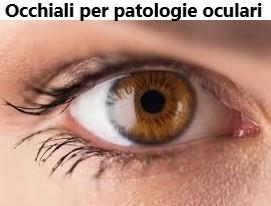 Occhiali per Patologie Oculari 